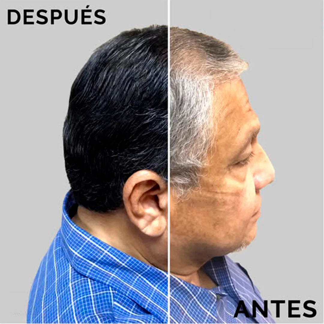 Shampoo Pinta Canas [Cubre 100%]
